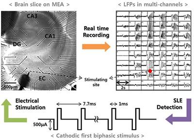 Prediction of the Seizure Suppression Effect by Electrical Stimulation via a Computational Modeling Approach